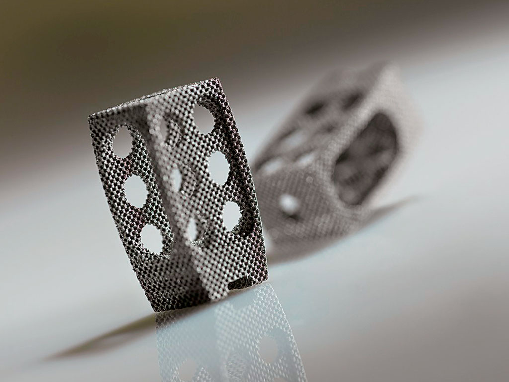 An additively manufactured titanium mesh spinal cage. Source: Concept Laser